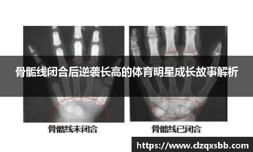 骨骺线闭合后逆袭长高的体育明星成长故事解析